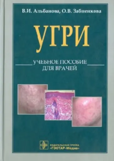 Альбанова, Забненкова - L70. Угри. Учебное пособие для врачей обложка книги