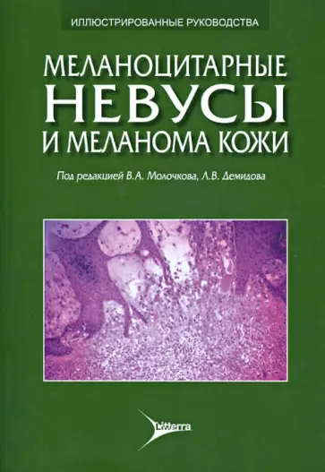 Молочков, Демидов - Меланоцитарные невусы и меланома кожи. Руководство для практикующих врачей обложка книги
