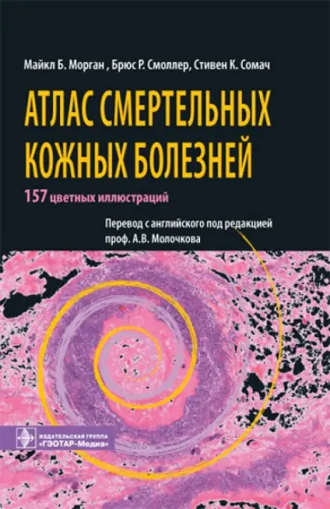 Морган, Смоллер - Атлас смертельных кожных болезней обложка книги