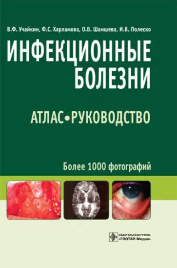 Учайкин, Шамшева - Инфекционные болезни. Атлас: руководство Учайкин, Шамшева - Инфекционные болезни. Атлас: руководство обложка книги
