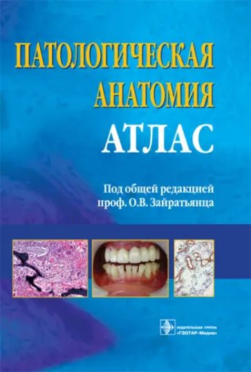 Зайратьянц, Кременецкая - Патологическая анатомия. Атлас: учебное пособие Зайратьянц, Кременецкая - Патологическая анатомия. Атлас: учебное пособие обложка книги