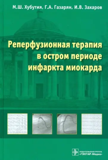 Хубутия, Газарян - Реперфузионная терапия в остром периоде инфаркта миокарда Хубутия, Газарян - Реперфузионная терапия в остром периоде инфаркта миокарда обложка книги