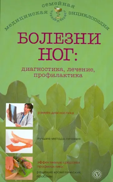 Е.М. Савельева - Болезни ног. Диагностика, лечение, профилактика обложка книги
