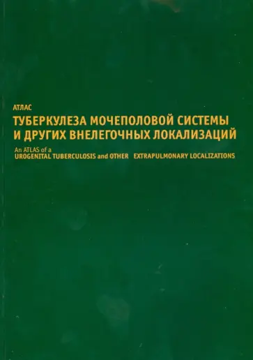 Кульчавеня, Филимонов - Атлас туберкулеза мочеполовой системы и других внелегочных локализаций обложка книги