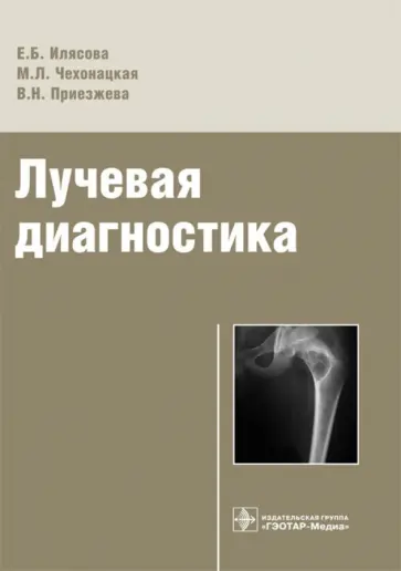Илясова, Чехонацкая - Лучевая диагностика. Учебное пособие Илясова, Чехонацкая - Лучевая диагностика. Учебное пособие обложка книги