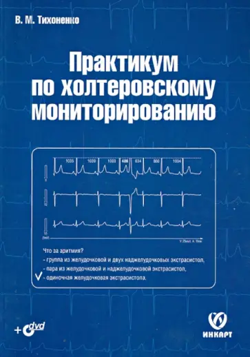 Виктор Тихоненко - Практикум по холтеровскому мониторированию (+DVD) обложка книги