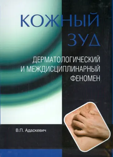 Владимир Адаскевич - Кожный зуд. Дерматологический и междисциплинарный феномен обложка книги