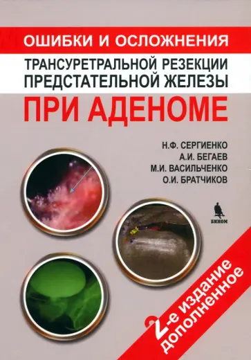 Сергиенко, Бегаев - Ошибки и осложнения трансуретральной резекции предстательной железы при аденоме обложка книги