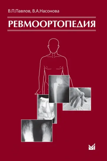 Павлов, Насонова - Ревмоортопедия Павлов, Насонова - Ревмоортопедия обложка книги