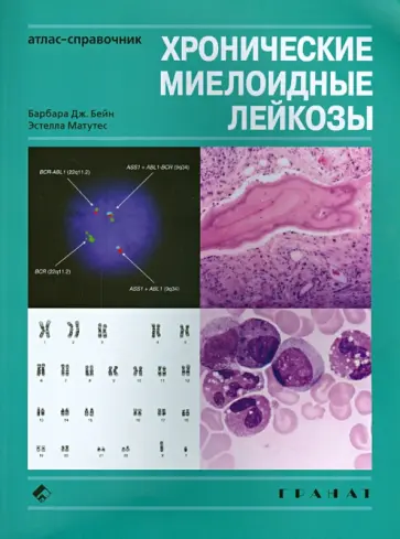 Бейн, Матутес - Хронические миелоидные лейкозы. Атлас-справочник обложка книги