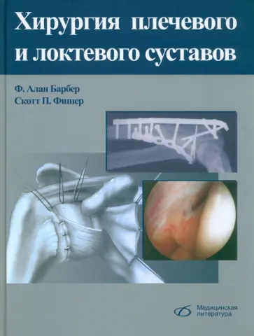 Барбер, Фишер - Хирургия плечевого и локтевого суставов Барбер, Фишер - Хирургия плечевого и локтевого суставов обложка книги