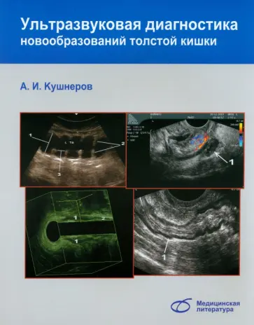 Александр Кушнеров - Ультразвуковая диагностика новообразований толстой кишки Александр Кушнеров - Ультразвуковая диагностика новообразований толстой кишки обложка книги