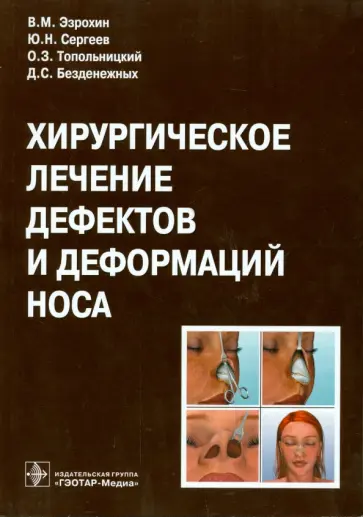 Эзрохин, Топольницкий - Хирургическое лечение дефектов и деформаций носа Эзрохин, Топольницкий - Хирургическое лечение дефектов и деформаций носа обложка книги