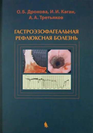 Дронова, Каган - Гастроэзофагеальная рефлюксная болезнь Дронова, Каган - Гастроэзофагеальная рефлюксная болезнь обложка книги