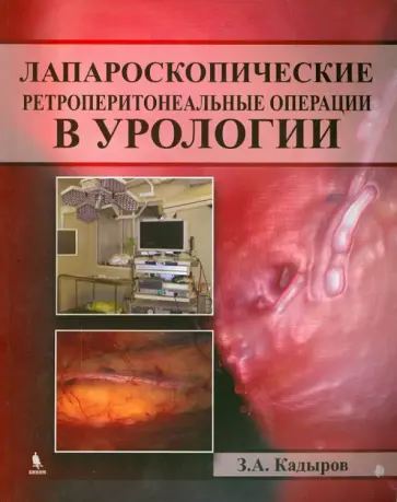 Кадыров, Сулейманов - Лапароскопические ретроперитонеальные операции в урологии обложка книги