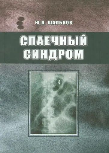 Юлий Шальков - Спаечный синдром обложка книги