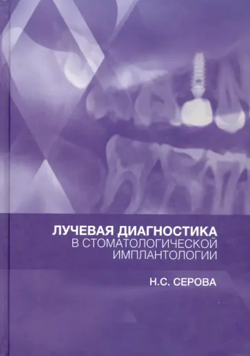 Наталья Серова - Лучевая диагностика в стоматологической имплантологии. Атлас Наталья Серова - Лучевая диагностика в стоматологической имплантологии. Атлас обложка книги