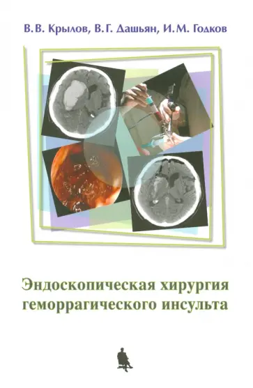 Крылов, Дашьян - Эндоскопическая хирургия геморрагического инсульта Крылов, Дашьян - Эндоскопическая хирургия геморрагического инсульта обложка книги