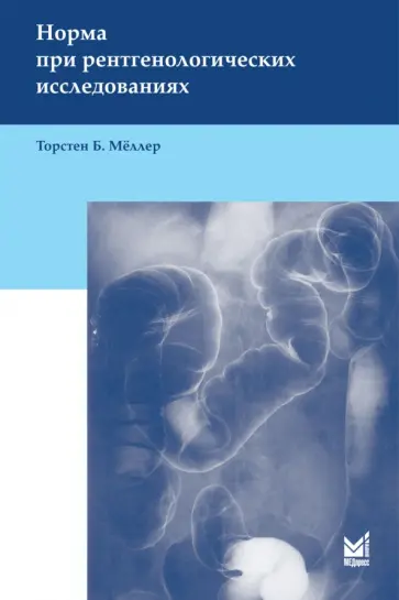 Торстен Меллер - Норма при рентгенологических исследованиях Торстен Меллер - Норма при рентгенологических исследованиях обложка книги