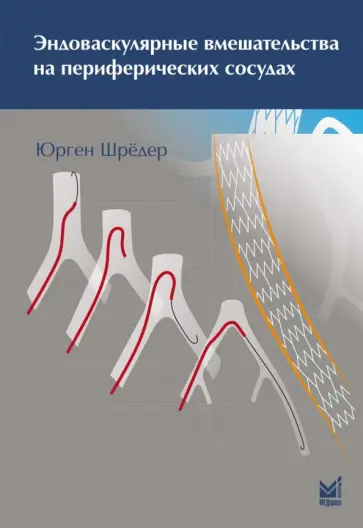 Юрген Шредер - Эндоваскулярные вмешательства на периферических сосудах обложка книги
