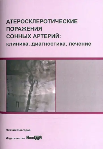 Иванов, Медведев - Атеросклеротические поражения сонных артерий Иванов, Медведев - Атеросклеротические поражения сонных артерий обложка книги