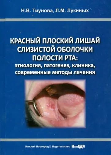 Лукиных, Тиунова - Красный плоский лишай слизистой оболочки полости рта (этиология, патогенез, клиника, современные мет Лукиных, Тиунова - Красный плоский лишай слизистой оболочки полости рта (этиология, патогенез, клиника, современные мет обложка книги