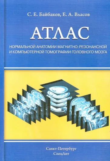 Байбаков, Власов - Атлас нормальной анатомии магнитно-резонансной и компьютерной томографии головного мозга. Уч. пособ. Байбаков, Власов - Атлас нормальной анатомии магнитно-резонансной и компьютерной томографии головного мозга. Уч. пособ. обложка книги