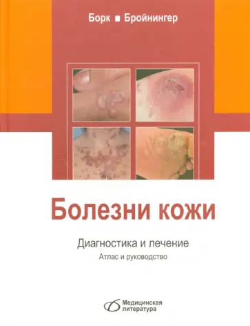 Борк, Бройнингер - Болезни кожи. Диагностика и лечение. Атлас и руководство Борк, Бройнингер - Болезни кожи. Диагностика и лечение. Атлас и руководство обложка книги