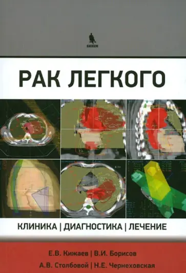 Чернеховская, Кижаев - Рак легкого. Клиника, диагностика, лечение Чернеховская, Кижаев - Рак легкого. Клиника, диагностика, лечение обложка книги
