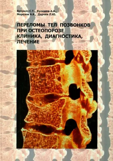 Ветрилэ, Морозов - Переломы тел позвонков при остеопорозе. Клиника, диагностика, лечение обложка книги