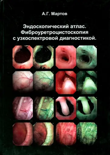 Андронов, Ергаков - Эндоскопический атлас. Фиброуретроцистоскопия с узкоспектровой диагностикой Андронов, Ергаков - Эндоскопический атлас. Фиброуретроцистоскопия с узкоспектровой диагностикой обложка книги