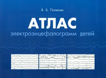 Вера Полякова - Атлас электороэнцифалограмм детей обложка книги