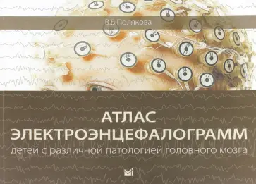 Вера Полякова - Атлас электроэнцефалограмм детей с различной патологией головного мозга Вера Полякова - Атлас электроэнцефалограмм детей с различной патологией головного мозга обложка книги