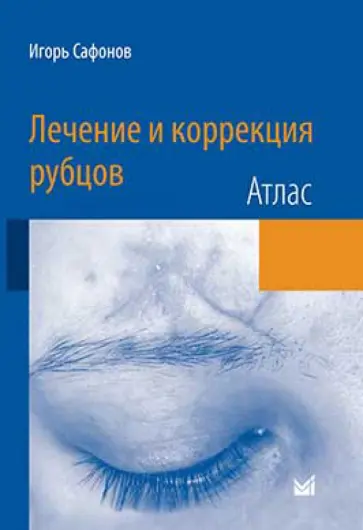 Игорь Сафонов - Лечение и коррекция рубцов. Атлас обложка книги
