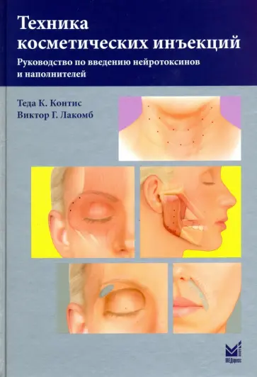 Контис, Лакомб - Техника косметических инъекций Контис, Лакомб - Техника косметических инъекций обложка книги