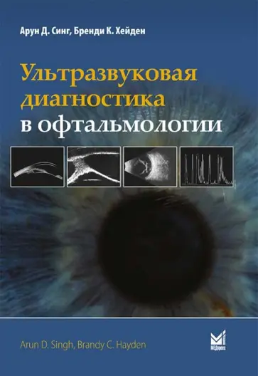Синг, Хейден - Ультразвуковая диагностика в офтальмологии Синг, Хейден - Ультразвуковая диагностика в офтальмологии обложка книги