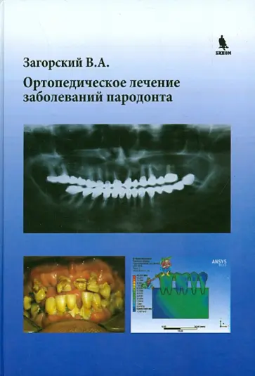 Валерий Загорский - Ортопедическое лечение заболеваний пародонта обложка книги
