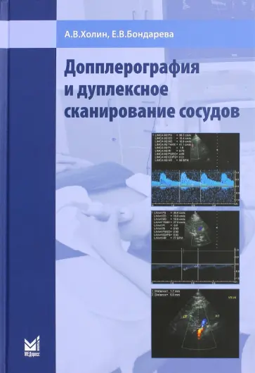 Холин, Бондарева - Допплерография и дуплексное сканирование сосудов обложка книги