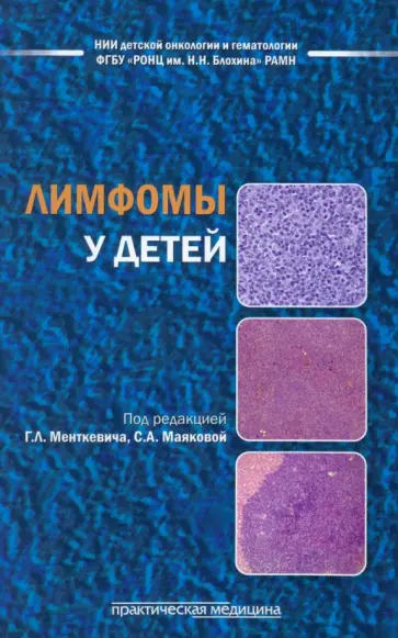 Менткевич, Маякова - Лимфомы у детей Менткевич, Маякова - Лимфомы у детей обложка книги