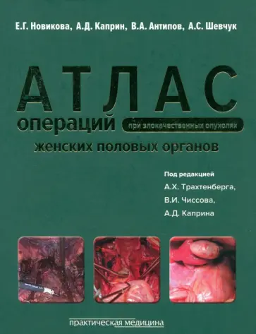 Каприн, Новикова - Операции при злокачественных опухолях женских половых органов Каприн, Новикова - Операции при злокачественных опухолях женских половых органов обложка книги