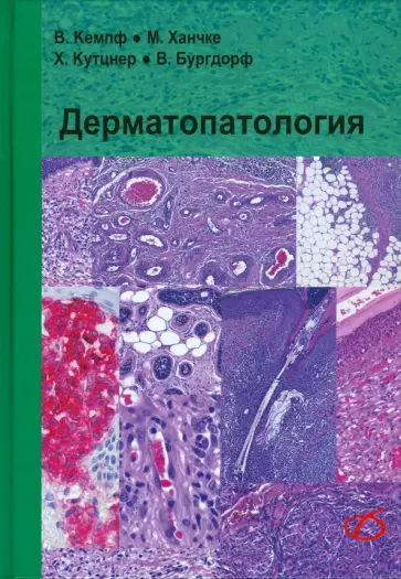 Кемпф, Ханчке - Дерматопатология Кемпф, Ханчке - Дерматопатология обложка книги