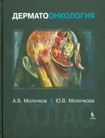 Молочкова, Молочков - Дерматоонкология. Атлас Молочкова, Молочков - Дерматоонкология. Атлас обложка книги