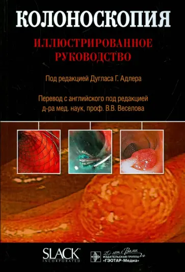 Колоноскопия. Иллюстрированное руководство Колоноскопия. Иллюстрированное руководство обложка книги