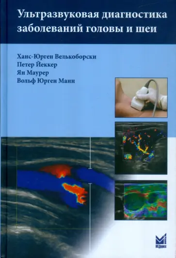 Велькоборски, Йеккер - Ультразвуковая диагностика заболеваний головы и шеи обложка книги