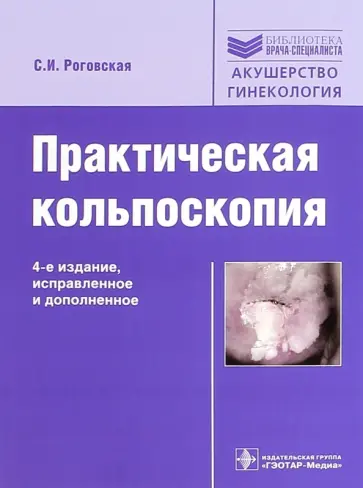 Светлана Роговская - Практическая кольпоскопия Светлана Роговская - Практическая кольпоскопия обложка книги