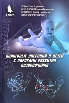 Лоран, Николаев - Слинговые операции у детей с пороками развития позвоночника обложка книги
