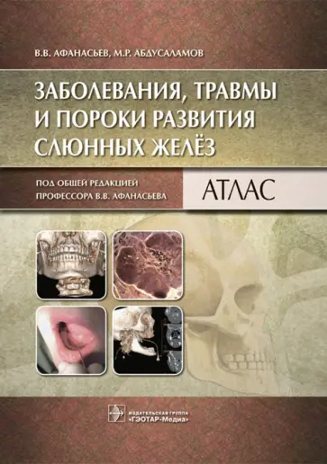 Афанасьев, Абдусаламов - Заболевания, травмы и пороки развития слюнных желез. Атлас обложка книги