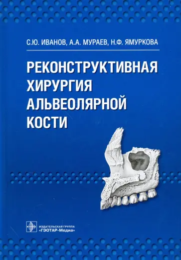 Иванов, Мураев - Реконструктивная хирургия альвеолярной кости Иванов, Мураев - Реконструктивная хирургия альвеолярной кости обложка книги