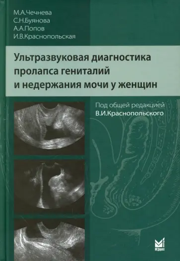 Попов, Буянова - Ультразвуковая диагностика пролапса гениталий и недержания мочи у женщин Попов, Буянова - Ультразвуковая диагностика пролапса гениталий и недержания мочи у женщин обложка книги