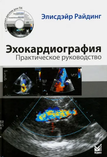 Элисдэйр Райдинг - Эхокардиография. Практическое руководство (+CD) Элисдэйр Райдинг - Эхокардиография. Практическое руководство (+CD) обложка книги